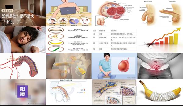 汕头男性 - 汕头为什么男人勃起功能障碍
