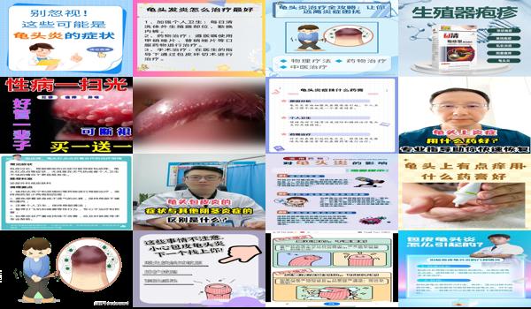 汕头男科性疾病 - 汕头龟头炎症治疗多久可以好