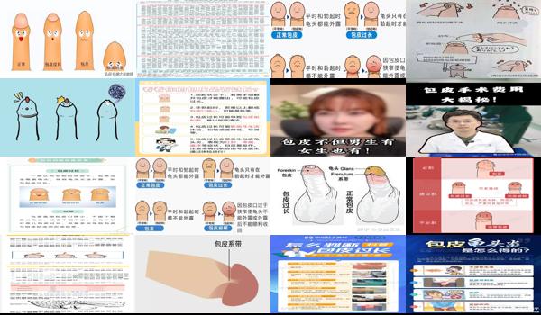 汕头包皮手术多少钱 - 汕头男生包皮是什么意思