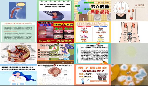 男性霉菌性尿道炎是什么症状 - 汕头男性霉菌性尿道炎症状