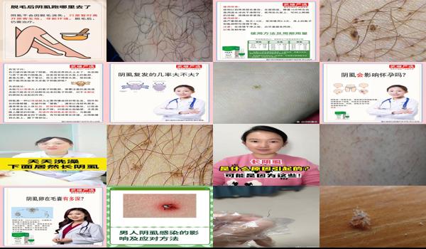 阴虱在头上会繁殖吗 - 汕头阴虱会自己长出来吗