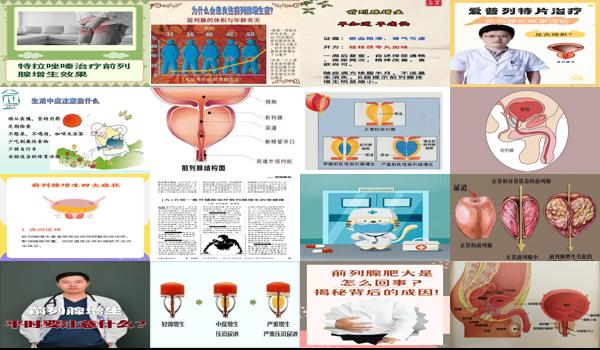 前列腺增生需要注意什么? - 汕头前列腺增生平时注意事项